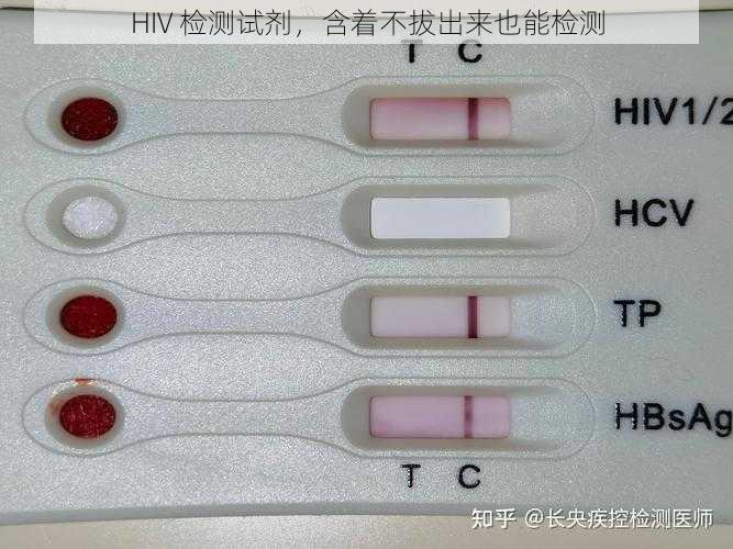 HIV 检测试剂，含着不拔出来也能检测